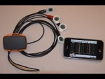 Smartphone Used To Detect Abnormal Heart Rhythms